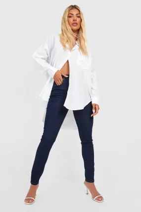 Basics Mid Rise Button Front Skinny Jeans